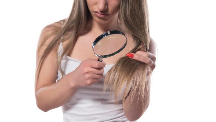 Rambut Rontok dan Ketombe: Tips Mengatasi Masalah Rambut